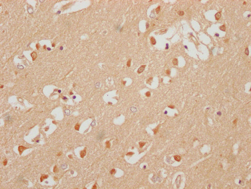 IHC image of CSB-PA618895LA01HU diluted at 1:200 and staining in paraffin-embedded human brain tissue performed on a Leica BondTM system. After dewaxing and hydration, antigen retrieval was mediated by high pressure in a citrate buffer (pH 6.0). Section was blocked with 10% normal goat serum 30min at RT. Then primary antibody (1% BSA) was incubated at 4°C overnight. The primary is detected by a Goat anti-rabbit polymer IgG labeled by HRP and visualized using 0.05% DAB.