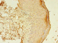 Immunohistochemistry of paraffin-embedded human skin tissue using CSB-PA618998LA01HU at dilution of 1:100