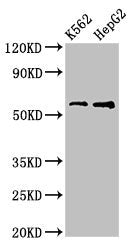 Western Blot
Positive WB detected in: K562 whole cell lysate, HepG2 whole cell lysate
All lanes: FSCN1 antibody at 3.2ug/ml
Secondary
Goat polyclonal to rabbit IgG at 1/50000 dilution
Predicted band size: 55 kDa
Observed band size: 55 kDa