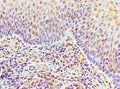 Immunohistochemistry of paraffin-embedded human tonsil tissue using CSB-PA619792ESR2HU at dilution of 1:100
