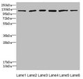 Western blot All lanes: UBE4A antibody at 2.24µg/ml Lane 1: K562 whole cell lysate Lane 2: MCF-7 whole cell lysate Lane 3: Jurkat whole cell lysate Lane 4: Caco-2 whole cell lysate Lane 5: HepG2 whole cell lysate Lane 6: 293T whole cell lysate Secondary Goat polyclonal to rabbit IgG at 1/10000 dilution Predicted band size: 123, 124 kDa Observed band size: 123 kDa