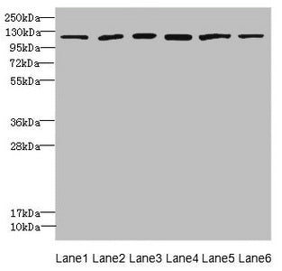 Western blot All lanes: UBE4A antibody at 2.24µg/ml Lane 1: K562 whole cell lysate Lane 2: MCF-7 whole cell lysate Lane 3: Jurkat whole cell lysate Lane 4: Caco-2 whole cell lysate Lane 5: HepG2 whole cell lysate Lane 6: 293T whole cell lysate Secondary Goat polyclonal to rabbit IgG at 1/10000 dilution Predicted band size: 123, 124 kDa Observed band size: 123 kDa