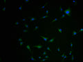 Immunofluorescence staining of U251 cells with CSB-PA619877LA01HU-IF at 1:100, counter-stained with DAPI. The cells were fixed in 4% formaldehyde and blocked in 10% normal Goat Serum. The cells were then incubated with the antibody overnight at 4°C. The secondary antibody was Alexa Fluor 488-congugated AffiniPure Goat Anti-Rabbit IgG(H+L).