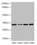 Western blot
All lanes: PDCD1 antibody at 6µg/ml
Lane 1: 293T whole cell lysate
Lane 2: Hela whole cell lysate
Lane 3: K562 whole cell lysate
Lane 4: Mouse stomach tissue
Secondary
Goat polyclonal to rabbit IgG at 1/10000 dilution
Predicted band size: 32 kDa
Observed band size: 32 kDa