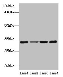 Western blot
All lanes: PDCD1 antibody at 6µg/ml
Lane 1: 293T whole cell lysate
Lane 2: Hela whole cell lysate
Lane 3: K562 whole cell lysate
Lane 4: Mouse stomach tissue
Secondary
Goat polyclonal to rabbit IgG at 1/10000 dilution
Predicted band size: 32 kDa
Observed band size: 32 kDa