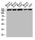 Western blot analysis of Mouse kidney tissue, Mouse brain tissue, Mouse lung tissue, Mouse heart tissue, 293T whole cell lysate, antibody was diluted at 1000. Secondary antibody was diluted at 1:20000