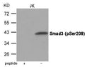 Western blot analysis of extracts from JK cells using Smad3 (Phospho-Ser208) Antibody.The lane on the left is treated with the antigen-specific peptide.