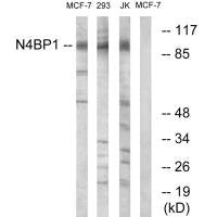 Western blot analysis of extracts from MCF-7 cells, 293 cells and Jurkat cells, using N4BP1 antibody.