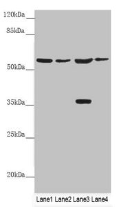 Western blot All lanes: SLC1A5 antibody at 9.89 ug/ml Lane 1: Mouse lung tissue Lane 2: Jurkat whole cell lysate Lane 3: 293T whole cell lysate Lane 4: Hela whole cell lysate Secondary Goat polyclonal to rabbit IgG at 1/10000 dilution Predicted band size: 57, 37, 34 kDa Observed band size: 57, 37 kDa