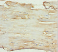 Immunohistochemistry of paraffin-embedded human skeletal muscle tissue using CSB-PA620892DSR2HU at dilution of 1:100