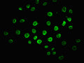 Immunofluorescence staining of A549 cells with CSB-PA620976LA01HU at 1:100, counter-stained with DAPI. The cells were fixed in 4% formaldehyde, permeabilized using 0.2% Triton X-100 and blocked in 10% normal Goat Serum. The cells were then incubated with the antibody overnight at 4&deg;C. The secondary antibody was Alexa Fluor 488-congugated AffiniPure Goat Anti-Rabbit IgG(H+L).