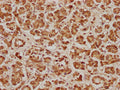 IHC image of CSB-PA620981LA01HU diluted at 1:100 and staining in paraffin-embedded human pancreatic tissue performed on a Leica BondTM system. After dewaxing and hydration, antigen retrieval was mediated by high pressure in a citrate buffer (pH 6.0). Section was blocked with 10% normal goat serum 30min at RT. Then primary antibody (1% BSA) was incubated at 4°C overnight. The primary is detected by a biotinylated secondary antibody and visualized using an HRP conjugated SP system.