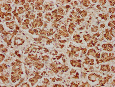 IHC image of CSB-PA620981LA01HU diluted at 1:100 and staining in paraffin-embedded human pancreatic tissue performed on a Leica BondTM system. After dewaxing and hydration, antigen retrieval was mediated by high pressure in a citrate buffer (pH 6.0). Section was blocked with 10% normal goat serum 30min at RT. Then primary antibody (1% BSA) was incubated at 4°C overnight. The primary is detected by a biotinylated secondary antibody and visualized using an HRP conjugated SP system.