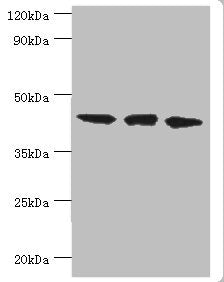 Western blot
All lanes: TAR DNA-binding protein 43 antibody at 8ug/ml
Lane 1: Hela whole cell lysate
Lane 2: Mouse spleen tissue
Lane: K562 whole cell lysate
Secondary
Goat polyclonal to rabbit IgG at 1/10000 dilution
Predicted band size: 45, 32 kDa
Observed band size: 45 kDa