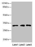 Western blot
All lanes: PRDX4 antibody at 8µg/ml
Lane 1: HepG2 whole cell lysate
Lane 2: Hela whole cell lysate
Lane 3: 293T whole cell lysate
Secondary
Goat polyclonal to rabbit IgG at 1/10000 dilution
Predicted band size: 31 kDa
Observed band size: 31 kDa