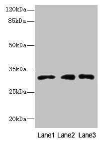 Western blot
All lanes: PRDX4 antibody at 8µg/ml
Lane 1: HepG2 whole cell lysate
Lane 2: Hela whole cell lysate
Lane 3: 293T whole cell lysate
Secondary
Goat polyclonal to rabbit IgG at 1/10000 dilution
Predicted band size: 31 kDa
Observed band size: 31 kDa
