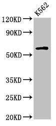 Western Blot
Positive WB detected in: K562 whole cell lysate
All lanes: IL10RA antibody at 2.7µg/ml
Secondary
Goat polyclonal to rabbit IgG at 1/50000 dilution
Predicted band size: 64 kDa
Observed band size: 64 kDa