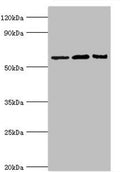 Western blot
All lanes: Interleukin-10 receptor subunit alpha antibody at 8ug/ml
Lane 1: Mouse heart tissue
Lane 2: Hela whole cell lysate
Lane 3: Mouse liver tissue
Secondary
Goat polyclonal to rabbit IgG at 1/10000 dilution
Predicted band size: 63 kDa
Observed band size: 63 kDa