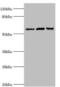 Western blot
All lanes: Interleukin-10 receptor subunit alpha antibody at 8ug/ml
Lane 1: Mouse heart tissue
Lane 2: Hela whole cell lysate
Lane 3: Mouse liver tissue
Secondary
Goat polyclonal to rabbit IgG at 1/10000 dilution
Predicted band size: 63 kDa
Observed band size: 63 kDa