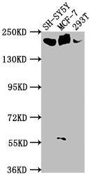Western Blot
Positive WB detected in: SH-SY5Y whole cell lysate, MCF-7 whole cell lysate, 293T whole cell lysate
All lanes: LAMA4 antibody at 1:1000
Secondary
Goat polyclonal to rabbit IgG at 1/50000 dilution
Predicted band size: 203, 202, 13 kDa
Observed band size: 203 kDa