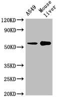 Western Blot
Positive WB detected in: A549 whole cell lysate, Mouse liver tissue
All lanes: CYP2A13 antibody at 1:2000
Secondary
Goat polyclonal to rabbit IgG at 1/50000 dilution
Predicted band size: 57 kDa
Observed band size: 57 kDa