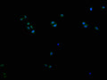 Immunofluorescence staining of Hela cells with CSB-PA621969LA11HU at 1:200, counter-stained with DAPI. The cells were fixed in 4% formaldehyde and blocked in 10% normal Goat Serum. The cells were then incubated with the antibody overnight at 4°C. The secondary antibody was Alexa Fluor 488-congugated AffiniPure Goat Anti-Rabbit IgG(H+L).