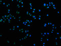 Immunofluorescence staining of Hela cells with CSB-PA621969LA21HU at 1:100, counter-stained with DAPI. The cells were fixed in 4% formaldehyde and blocked in 10% normal Goat Serum. The cells were then incubated with the antibody overnight at 4°C. The secondary antibody was Alexa Fluor 488-congugated AffiniPure Goat Anti-Rabbit IgG(H+L).