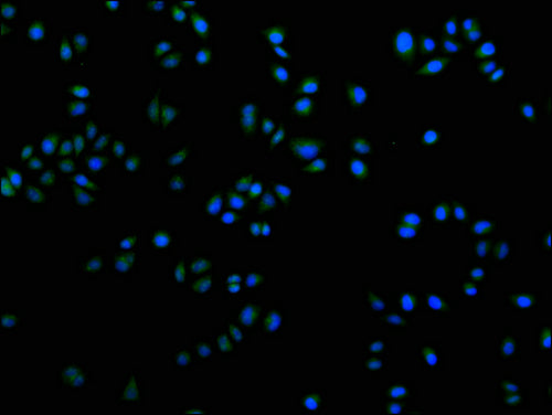 Immunofluorescence staining of Hela cells with CSB-PA621969LA21HU at 1:100, counter-stained with DAPI. The cells were fixed in 4% formaldehyde and blocked in 10% normal Goat Serum. The cells were then incubated with the antibody overnight at 4°C. The secondary antibody was Alexa Fluor 488-congugated AffiniPure Goat Anti-Rabbit IgG(H+L).