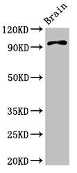 Western Blot
Positive WB detected in: Mouse brain tissue
All lanes: ABR antibody at 3.4ug/ml
Secondary
Goat polyclonal to rabbit IgG at 1/50000 dilution
Predicted band size: 98, 94, 36, 93 kDa
Observed band size: 98 kDa