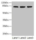 Western blot
All lanes: ACAP1 antibody at 4µg/ml
Lane 1: Mouse lung tissue
Lane 2: Jurkat whole cell lysate
Lane 3: K562 whole cell lysate
Secondary
Goat polyclonal to rabbit IgG at 1/10000 dilution
Predicted band size: 82 kDa
Observed band size: 82 kDa