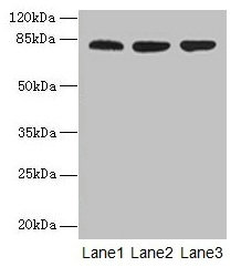 Western blot
All lanes: ACAP1 antibody at 4µg/ml
Lane 1: Mouse lung tissue
Lane 2: Jurkat whole cell lysate
Lane 3: K562 whole cell lysate
Secondary
Goat polyclonal to rabbit IgG at 1/10000 dilution
Predicted band size: 82 kDa
Observed band size: 82 kDa