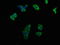 Immunofluorescence staining of HepG2 cells with CSB-PA623000LA01HU at 1:100, counter-stained with DAPI. The cells were fixed in 4% formaldehyde, permeabilized using 0.2% Triton X-100 and blocked in 10% normal Goat Serum. The cells were then incubated with the antibody overnight at 4°C. The secondary antibody was Alexa Fluor 488-congugated AffiniPure Goat Anti-Rabbit IgG(H+L).