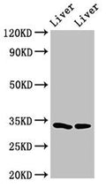 Western Blot
Positive WB detected in: Rat liver tissue, Mouse liver tissue
All lanes: RGN antibody at 3ug/ml
Secondary
Goat polyclonal to rabbit IgG at 1/50000 dilution
Predicted band size: 34, 25 kDa
Observed band size: 34 kDa