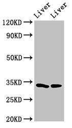 Western Blot
Positive WB detected in: Rat liver tissue, Mouse liver tissue
All lanes: RGN antibody at 3ug/ml
Secondary
Goat polyclonal to rabbit IgG at 1/50000 dilution
Predicted band size: 34, 25 kDa
Observed band size: 34 kDa