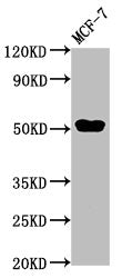 Western Blot
Positive WB detected in: MCF-7 whole cell lysate
All lanes: CCDC6 antibody at 3µg/ml
Secondary
Goat polyclonal to rabbit IgG at 1/50000 dilution
Predicted band size: 54 kDa
Observed band size: 54 kDa
