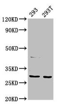 Western Blot
Positive WB detected in: 293 whole cell lysate, 293T whole cell lysate
All lanes: AANAT antibody at 7.5ug/ml
Secondary
Goat polyclonal to rabbit IgG at 1/50000 dilution
Predicted band size: 24, 29 kDa
Observed band size: 29 kDa