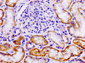 IHC image of CSB-PA623096LA01HU diluted at 1:100 and staining in paraffin-embedded human kidney tissue performed on a Leica BondTM system. After dewaxing and hydration, antigen retrieval was mediated by high pressure in a citrate buffer (pH 6.0). Section was blocked with 10% normal goat serum 30min at RT. Then primary antibody (1% BSA) was incubated at 4&deg;C overnight. The primary is detected by a biotinylated secondary antibody and visualized using an HRP conjugated SP system.