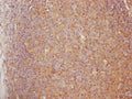IHC image of CSB-PA623792LA01HU diluted at 1:100 and staining in paraffin-embedded human lymph node tissue performed on a Leica BondTM system. After dewaxing and hydration, antigen retrieval was mediated by high pressure in a citrate buffer (pH 6.0). Section was blocked with 10% normal goat serum 30min at RT. Then primary antibody (1% BSA) was incubated at 4°C overnight. The primary is detected by a Goat anti-rabbit polymer IgG labeled by HRP and visualized using 0.05% DAB.