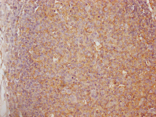 IHC image of CSB-PA623792LA01HU diluted at 1:100 and staining in paraffin-embedded human lymph node tissue performed on a Leica BondTM system. After dewaxing and hydration, antigen retrieval was mediated by high pressure in a citrate buffer (pH 6.0). Section was blocked with 10% normal goat serum 30min at RT. Then primary antibody (1% BSA) was incubated at 4°C overnight. The primary is detected by a Goat anti-rabbit polymer IgG labeled by HRP and visualized using 0.05% DAB.