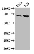 Western Blot
Positive WB detected in: Hela whole cell lysate, PC-3 whole cell lysate
All lanes: CUL2 antibody at 5µg/ml
Secondary
Goat polyclonal to rabbit IgG at 1/50000 dilution
Predicted band size: 87, 90 kDa
Observed band size: 87 kDa