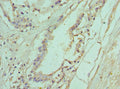 Immunohistochemistry of paraffin-embedded human prostate tissue using CSB-PA623927ESR1HU at dilution of 1:100