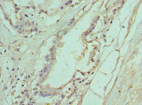 Immunohistochemistry of paraffin-embedded human prostate tissue using CSB-PA623927ESR1HU at dilution of 1:100