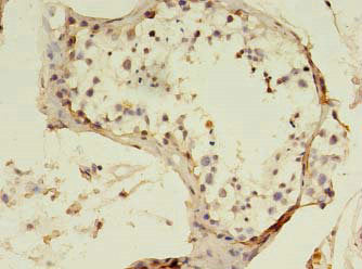 Immunohistochemistry of paraffin-embedded human testis tissue using CSB-PA624010HA01HU at dilution of 1:100