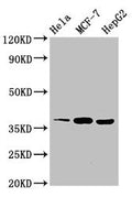 Western Blot
Positive WB detected in: Hela whole cell lysate, MCF-7 whole cell lysate, HepG2 whole cell lysate
All lanes: ALX1 antibody at 3ug/ml
Secondary
Goat polyclonal to rabbit IgG at 1/50000 dilution
Predicted band size: 37 kDa
Observed band size: 37 kDa