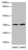 Western blot
All lanes: ACKR1 antibody at 2µg/ml
Lane 1: Mouse kidney tissue
Lane 2: Mouse spleen tissue
Secondary
Goat polyclonal to rabbit IgG at 1/10000 dilution
Predicted band size: 36 kDa
Observed band size: 36 kDa