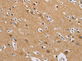 The image on the left is immunohistochemistry of paraffin-embedded Human brain tissue using CSB-PA627130(GNB5 Antibody) at dilution 1/20, on the right is treated with fusion protein. (Original magnification: ×200)