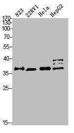 Western blot analysis of 823 22RV1 HELA HEPG2 Cell Lysate, antibody was diluted at 1:2000. Secondary antibody  was diluted at 1:20000