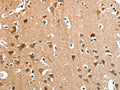 The image on the left is immunohistochemistry of paraffin-embedded Human brain tissue using CSB-PA632657(ANKRD54 Antibody) at dilution 1/50, on the right is treated with fusion protein. (Original magnification: ×200)