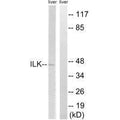 Western blot analysis of extracts from rat liver cells, using ILK (Ab-246) antibody.
