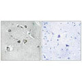 Immunohistochemistry analysis of paraffin-embedded human brain tissue, using Collagen XI α2 antibody.